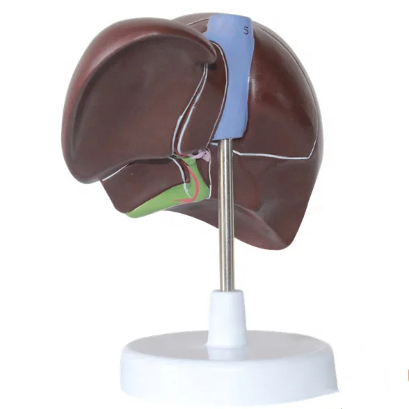 Medical Supplies Human Teaching Liver Pathological Model for School Display Tool Lab Equipment