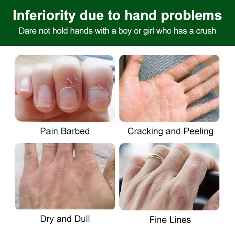 Оптовая продажа 30 г крем для рук сухой кожи увлажняющий Натуральный Лосьон из