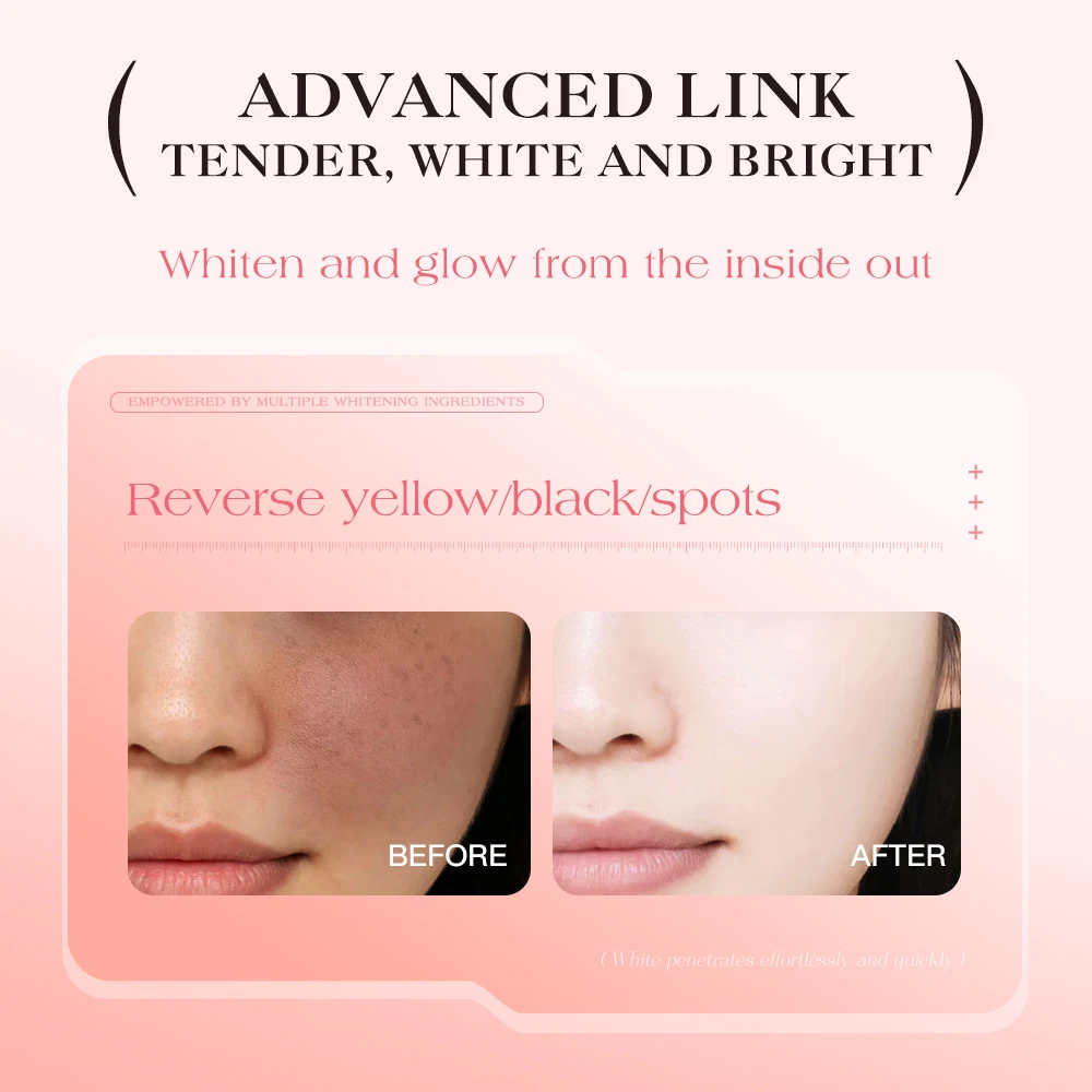 TWG Wholesale Tea Tree Extract Niacinamide&TXA Dark Spots Serum Anti Acne Whitening Skin Care Serum Moisturizing Anti Acne Serum