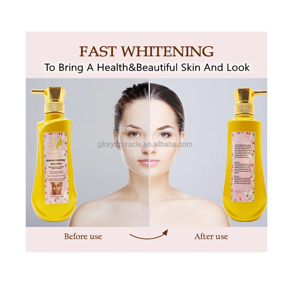 Advanced Intense Lightening Body Lotion Treatment For Dark Spots Clears Discoloration