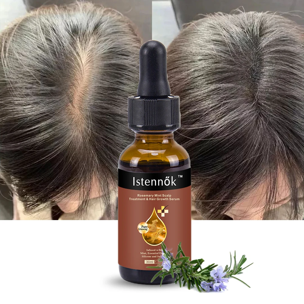 Восстанавливающая против выпадения восстанавливающая Мятная масляная сыворотка Elixirs для кожи головы от фирменного бренда, имбиря, розмарина, роста волос, 30 мл