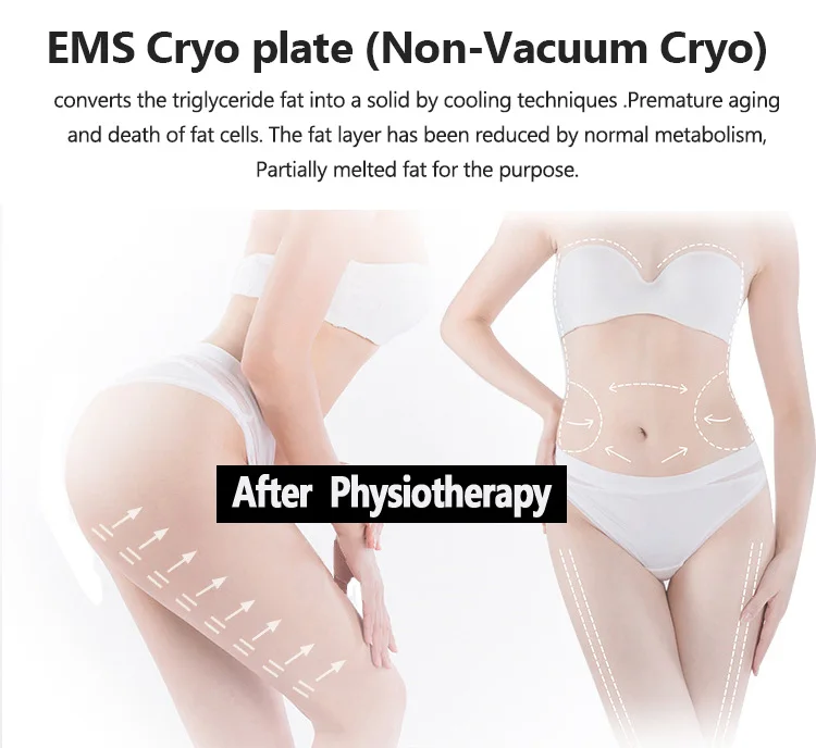 8 Pads Cryo Lipolysis Cryotherapy Fat Freezing Body Sculpting Machine 11 Discover the professional 8 Pads Cryo Lipolysis Cryotherapy Machine for non-invasive fat freezing, body sculpting, slimming, and advanced cryotherapy contouring treatments for salons and med spas. 8 Pads Cryo Lipolysis Cryotherapy Fat Freezing Body Sculpting Machine