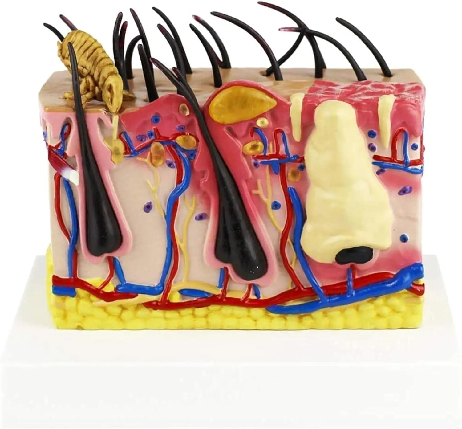 Skin Pustule Model Educational Model Bites Human Skin Anatomical Model Skin Irritation ...