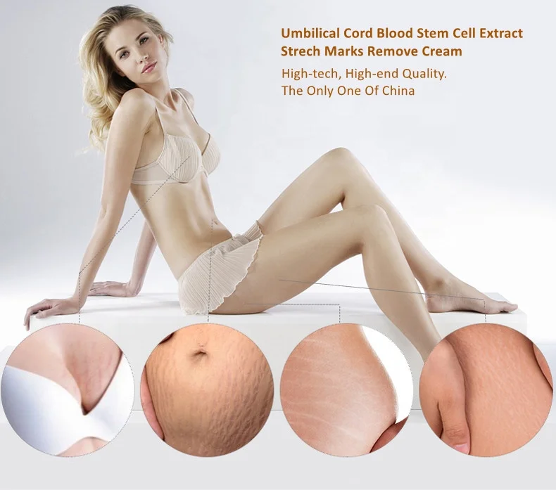 
Частной марки OEM 10 мл 15 мл 30 мл шрамы от акне ремонт глубокий Strech удаление меток сыворотка эссенция для шрамы удалить 