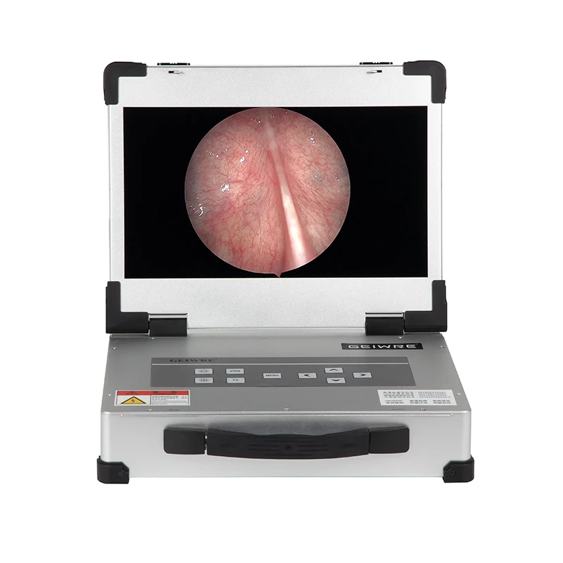 Geavanceerde laparoscopische trainerbox met HD 1080p endoscoopcamera Endoscopische HD-camera Ent endoscoopcamera