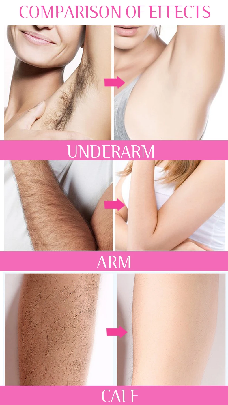 Creme Depilatório Orgânico Disaar Fast 3 Mins, Creme Removedor de Pelos Permanente e Indolor para Homens e Mulheres