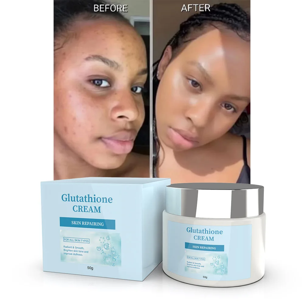 glutathione cream for black skin Oem Private Label Customize Anti Scar Repairing Whitening Lightening Cream Skin Smooth Brightening Cream IV Drip Therapy in