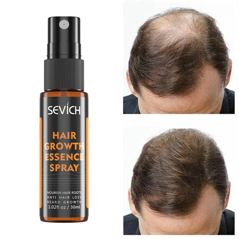Оптовая продажа с фабрики, питательное средство против выпадения волос, травяное восстанавливающее масло для роста волос, сыворотка-спрей