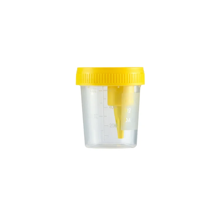 Sterile PP Vacuum Urine Sample Collection Cup Customizable OEM Medical Urine Specimen Container for Hospital & Laboratory Use