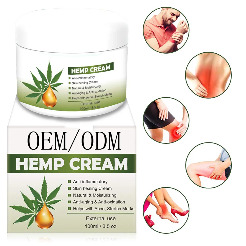 cbd cream for stretch marks