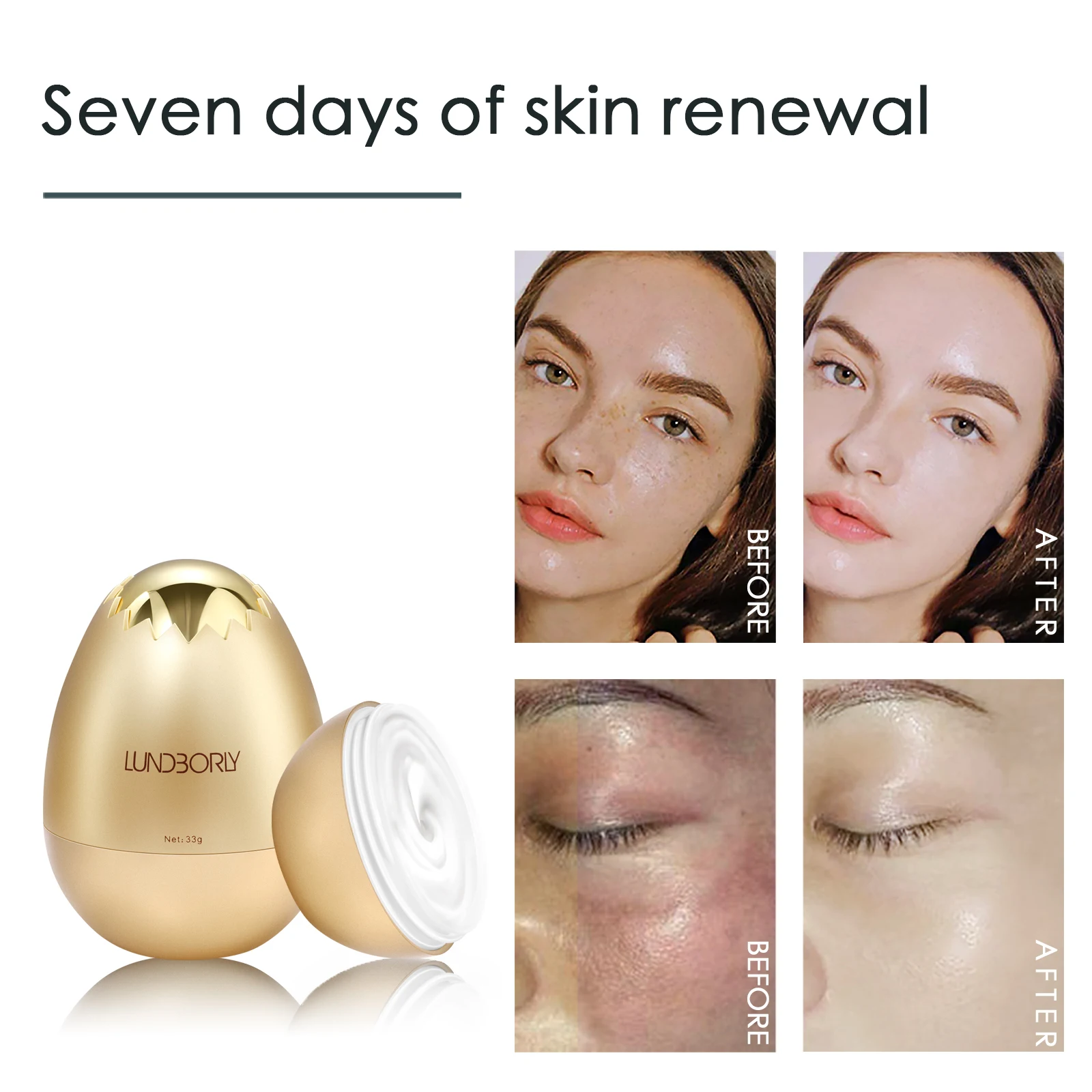 Lundborly 30g Woman Lady Face Whitening Cream For Dark Skin Spots Snow