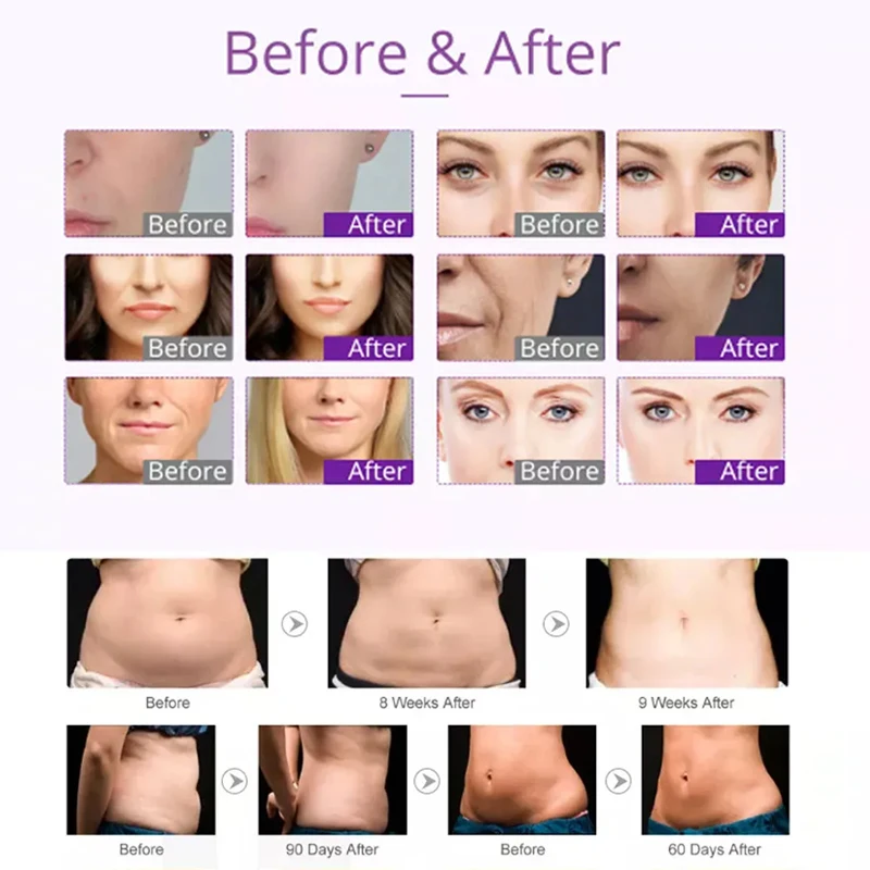 Заводская цена 4 в 1 машина для похудения 40 кГц ультразвуковая радиочастотная вакуумная кавитационная система для похудения