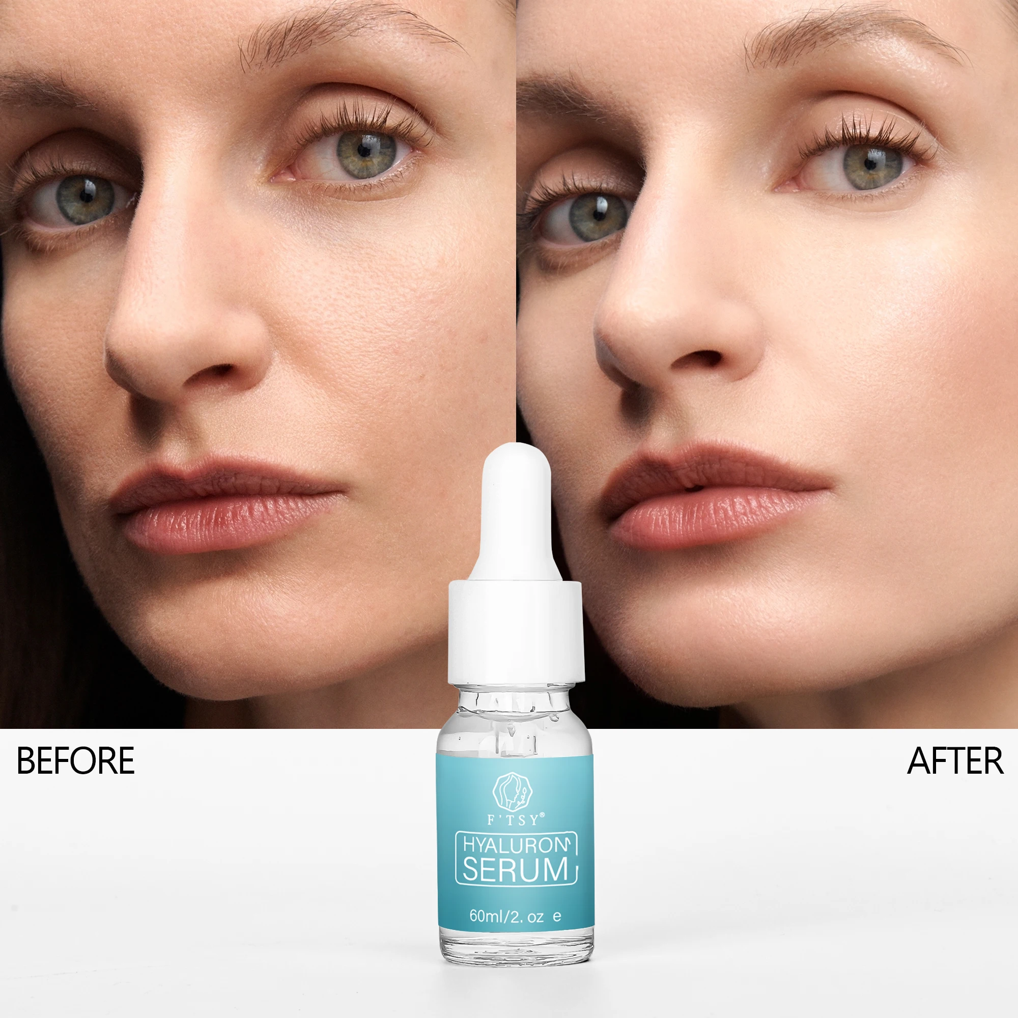 Bio-Aloe-Vera Feuchtigkeitsspendendes Hyaluronsure-Serum mit Vitamin C und  E fr Gesicht und Hautpflege| Alibaba.com
