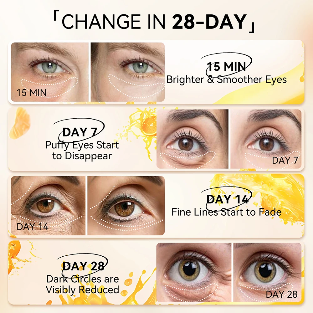 LANBENA Wholesale Vitamin C Moisturizing Whitening Remove Dark Circles Hydrogel Eye Patches factory