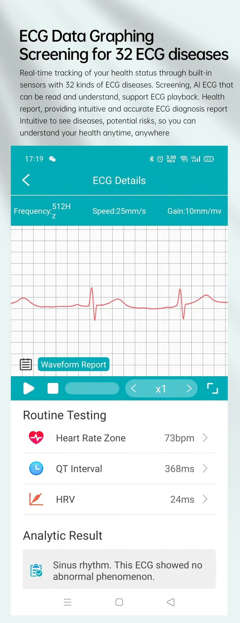 Intelligent ECG Blood Glucose Health Smart Watch 1.39 Inch HD Screen ECG Chest Patch Real Time ECG Analysis E400 Smart Watch (12).jpg