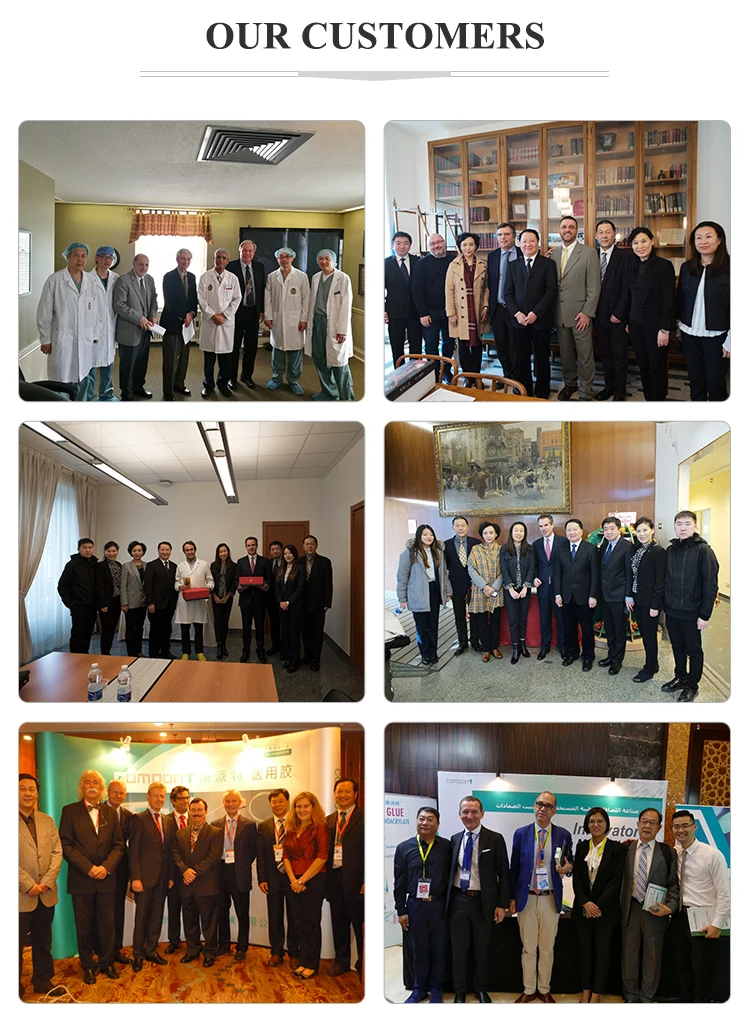 Medical Tissue Glue Embolization Nbutyl Cyanoacrylate Tissue Adhesive