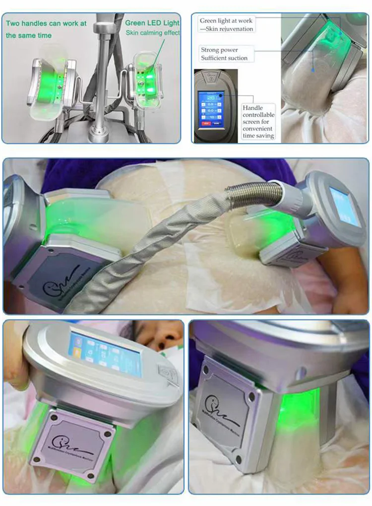 <p data-pm-slice="1 3 []">The Cryolipolysis and Body Slimming Machine is a multifunctional body contouring system designed for professional aesthetic salons, Med Spas, and beauty clinics. Combining controlled cooling, 40KHz ultrasonic cavitation, 6-polar radiofrequency (RF), and laser lipolysis in one platform, it offers multiple treatment modalities for customized body contouring services.</p> The system includes four cryolipolysis applicators—2 large, 1 medium, and 1 small—alongside dedicated cavitation, RF, and laser lipolysis attachments. With adjustable vacuum pressure of 0–80 kPa and a cooling range of -10°C to 10°C, it provides versatile configuration options for professional body treatment protocols. <strong>Key Features</strong> <ul data-spread="false"> <li>Multiple technologies integrated into one body contouring platform</li> <li>Four cryolipolysis applicators in three sizes</li> <li>40KHz ultrasonic cavitation</li> <li>6-polar RF handpiece for body contouring applications</li> <li>Laser lipolysis attachments with specified 100 mW-per-emitter output, subject to manufacturer confirmation</li> <li>Adjustable negative pressure from 0 to 80 kPa</li> <li>Dual-voltage options for different electrical markets, subject to configuration confirmation</li> </ul> Cryolipolysis Body Slimming Machine with Cavitation RF & Laser Lipolysis