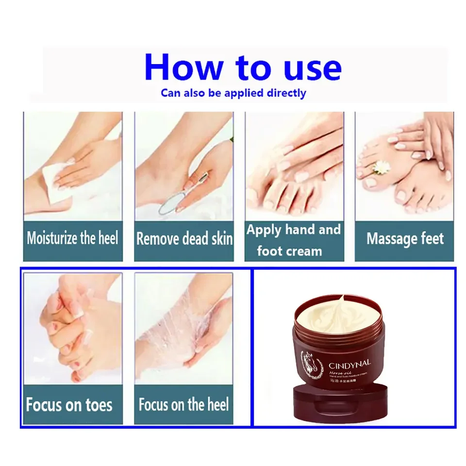 Anti Fungal Foot Repair Foot Cream Dead Skin Removal Peeling 