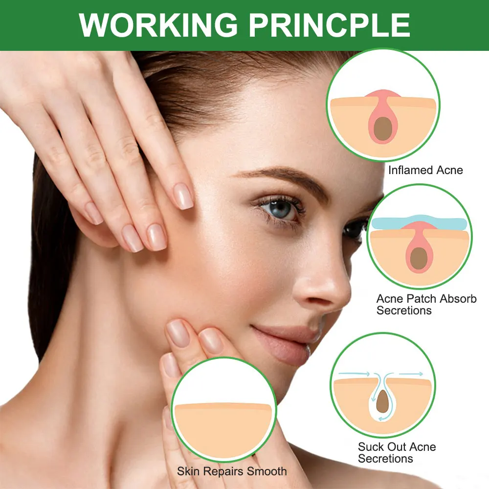 New Skin Care Hydrocolloid TeaTree Extract Treatment Acne Removal Plaster Master Pimple Acne Patch