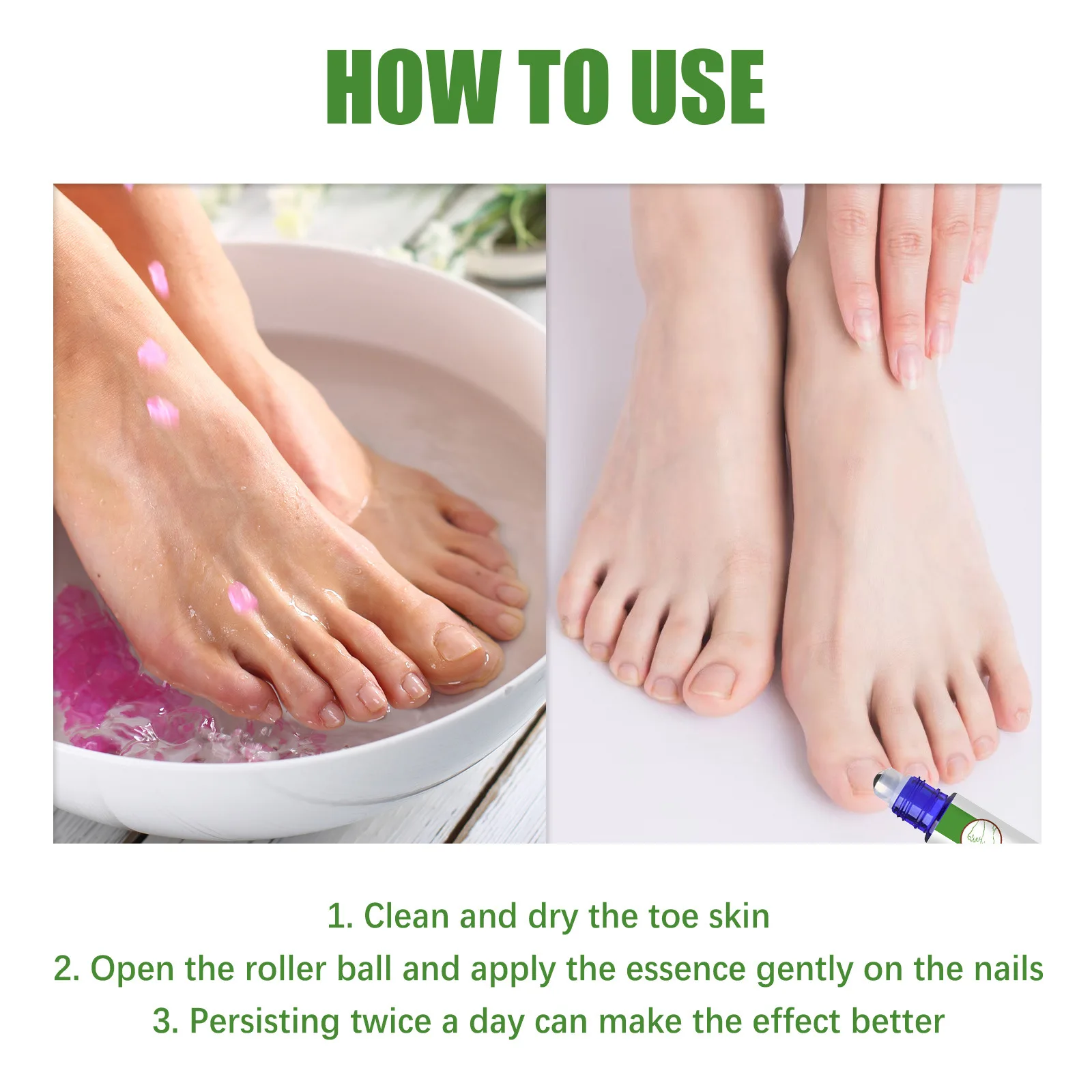 Extra Strength Toenail Fungus Treatment For Toenail Fingernail Nail
