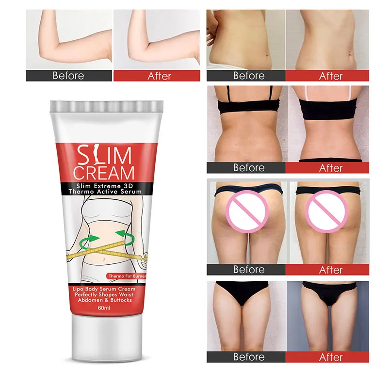 Оптовая продажа кофеин крем от ожогов антицеллюлитный крем для удаления тонкий укрепляющий крем для тела 60 мл