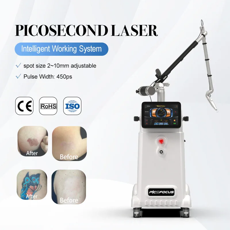 Beijing Nubway Remover Scars Tattoo Removal Professional Picosecond Laser Machine