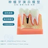 C dental implant yellow bottom black nail