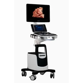 Color Ultrasound Chison CBit 9 transvaginal ultrasound machine brands 3D 4D Doppler gynecological ultrasound machine