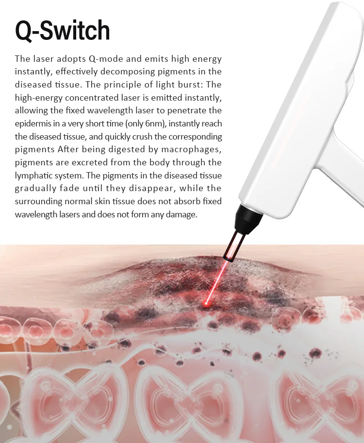 Portable 2 in 1 Q-SWITCH Tattoo Removal Carbon Peeling Skin Whitening Machine/ Fast IPL Hair Removal Machine