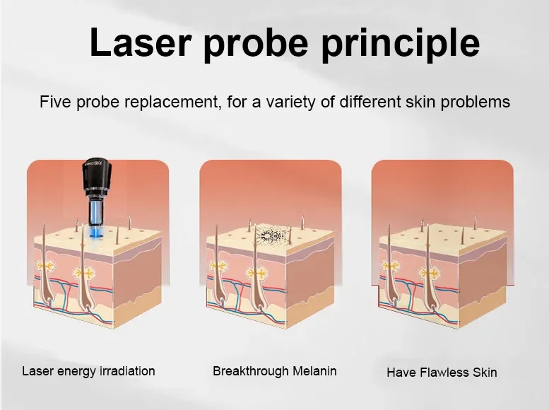 Picosecond Laser
