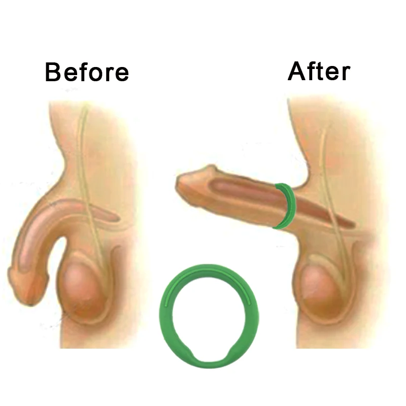 Health Enlargement Penis Ring With Negative Ions Silicone Men Sex Penis  Power Cock Rings Quantum Energy Power Sexual Ring