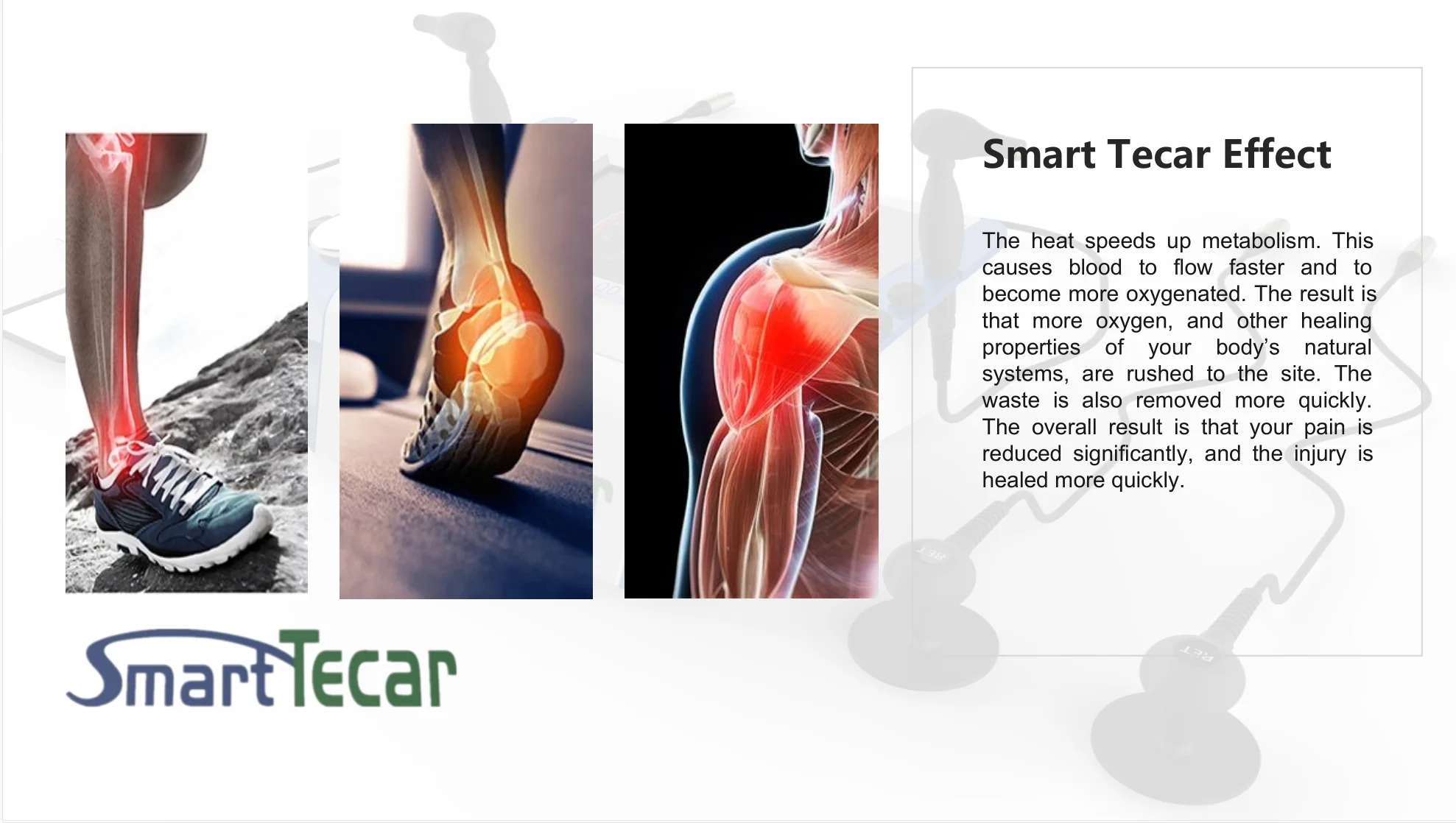 Tecar Xxx Video - Meicet | China Meicet Smart Tecar CET RET Pain Relief Physical Therapy  Equipment For Body Manufacture and Factory