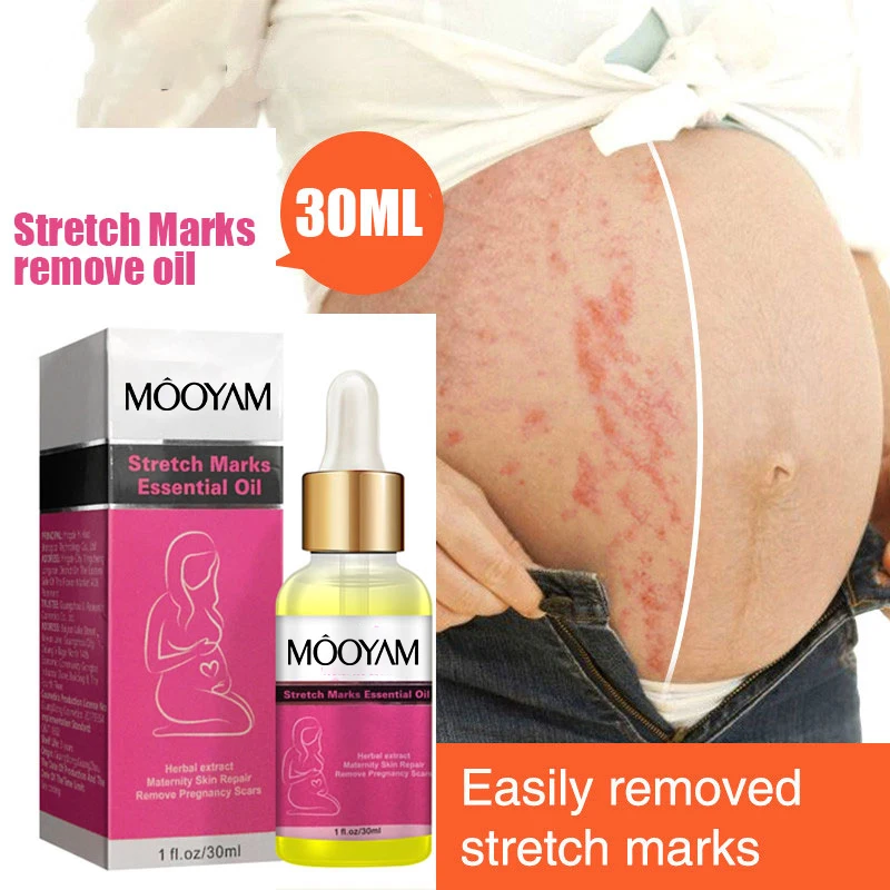 Private Label Stretch Marks Essential Oil Scar Oil 100 Natural Pure Plant Extract 7 Days