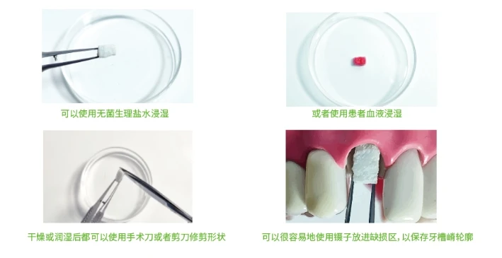 disposable Collagen Plug  Dental absorbable sponge Can be customized details