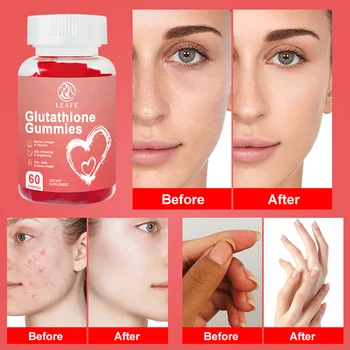 tác dụng glutathione Glutathione: Công Dụng, Liều Dùng, Tác Dụng Phụ