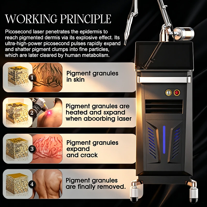 Picosecond working principle: pigment granules shattered pulse by pulse