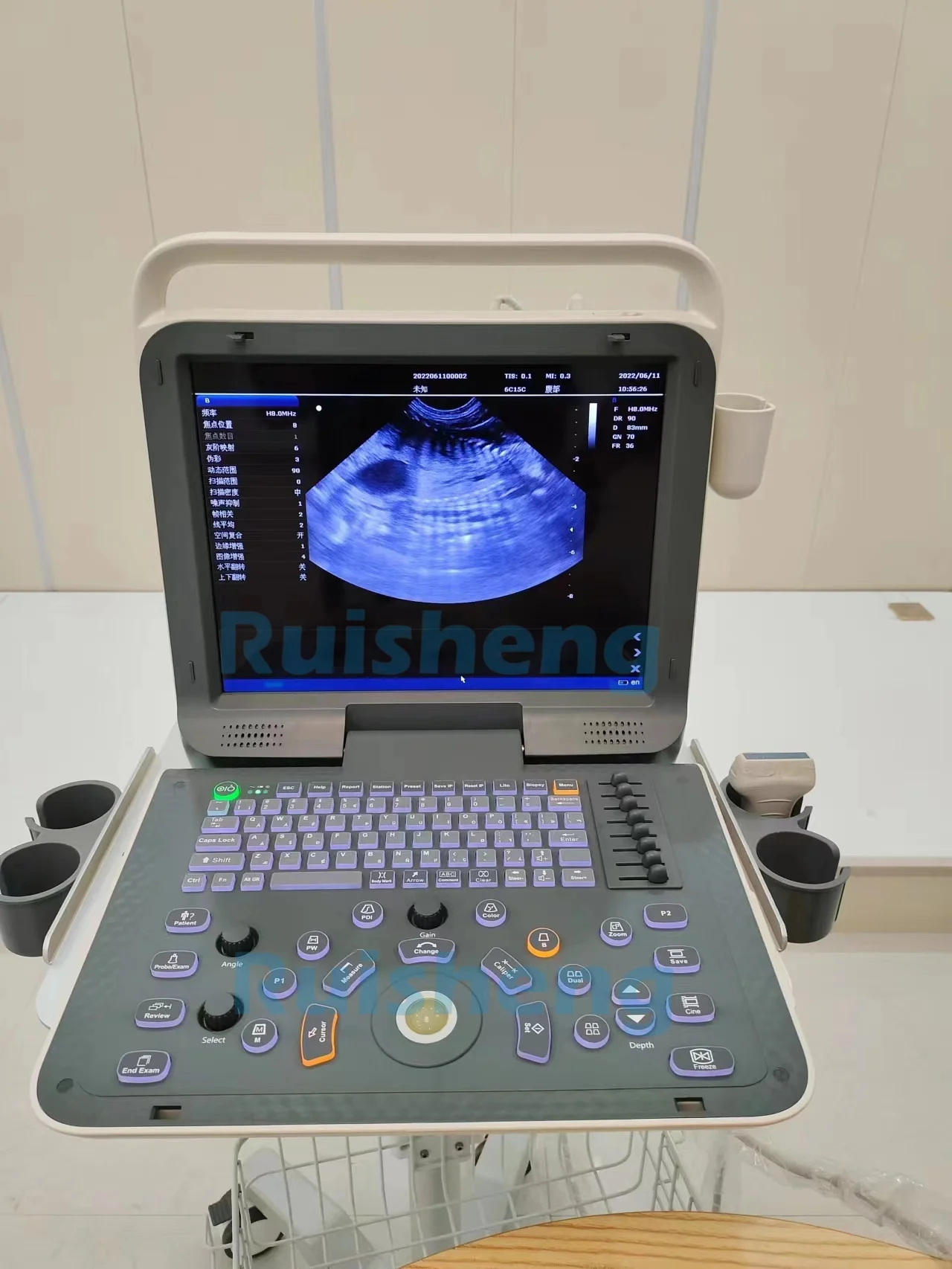 Transvaginal Machine Ruisheng RS-P60 Portable Vet Ultrasound - Transvaginal Probe