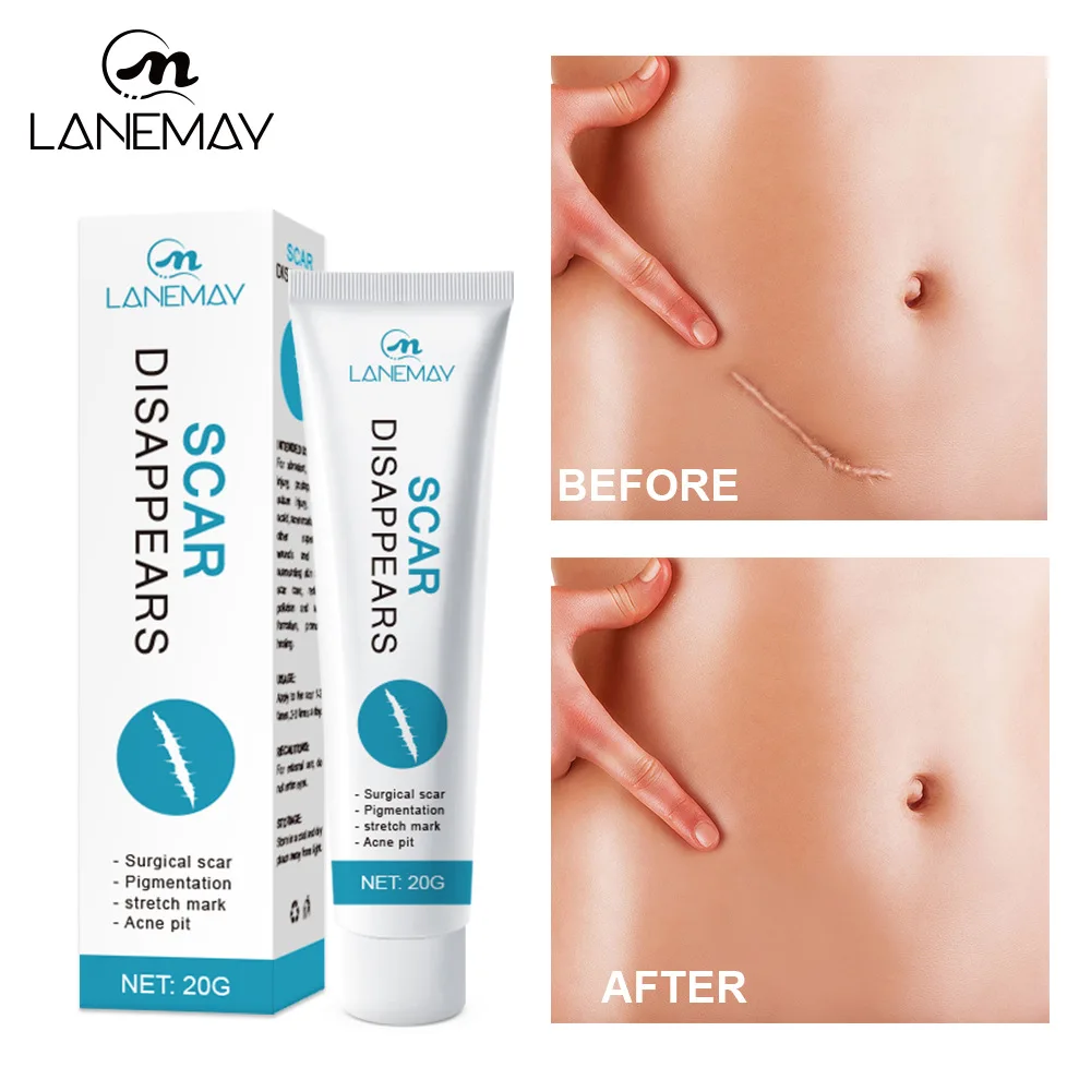 Alibaba.com: LANEMAY m574 Scar Disappears Cream, Pearl & Mineral for  Effective Scar Repairing & Skin Revitalization : OEM/ODM Supply Available
