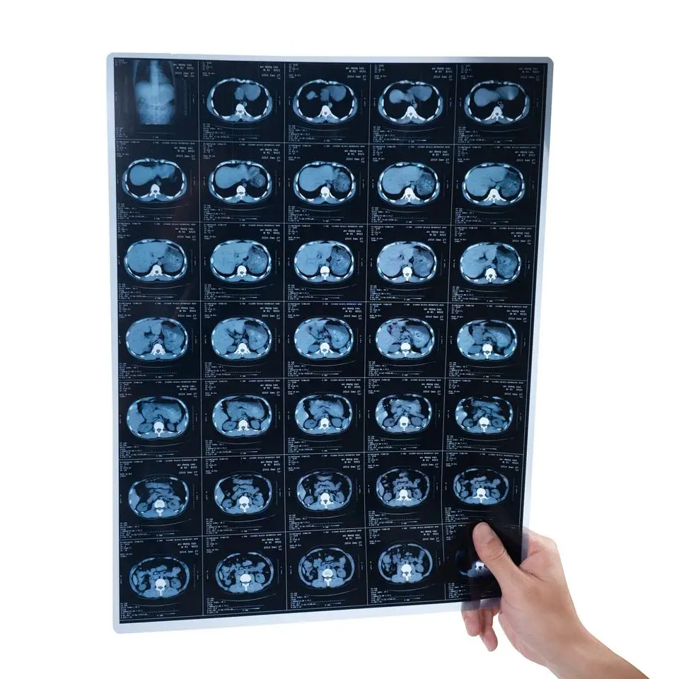 Blue PET Based Thermal Inkjet X Ray Film Medical Images For Clinic Hospitals