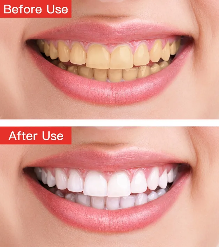 White Smile Coconut Oil Pulling Teeth Whitening Foam Strips Mild Tooth
