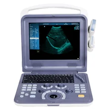 Ce iso approved  12.1 inch LED Player Ultrasound Doppler B/W B/M Black And White Ultrasound Scanner With Convex Probe