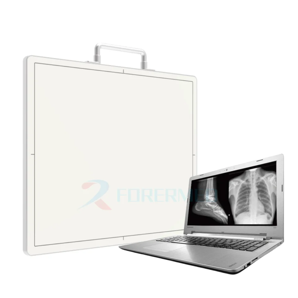 Mobile digital X ray Machine Price Mobile digital X ray Machine Price