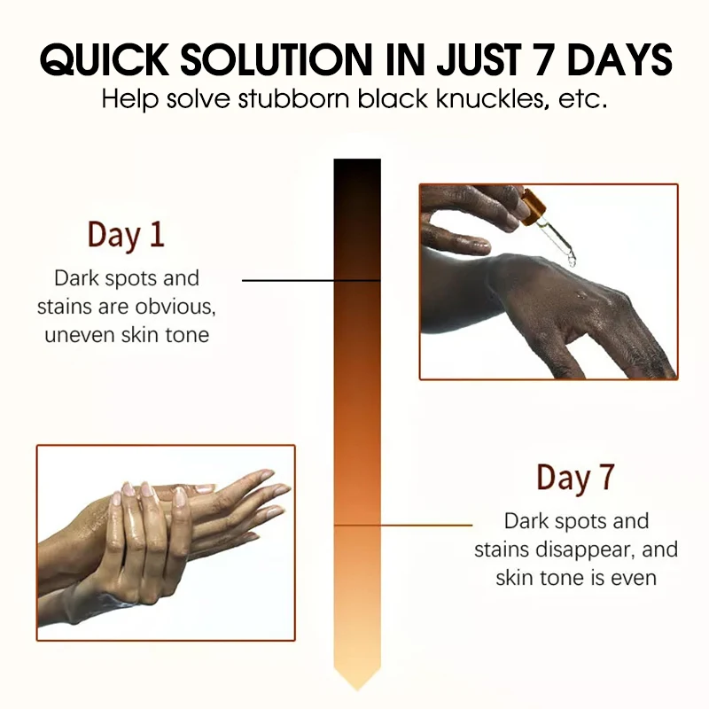glutathione for dark knuckles NU PARAX Face off Serum Black Spot Remover / Dark Knuckles Maintenance 25g main image 1