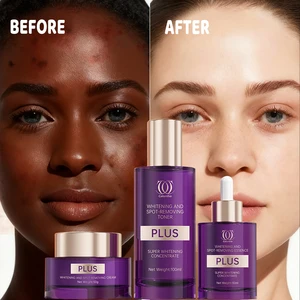 Calantha Vegan Anti-Aging 5 Days Bleaching Toner Double Vitamin C Serum Dark Spot Face Cream Whitening Skin Care Set