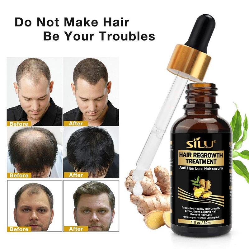 Custom 7 Days Fast Hair Growth Oil Treatment Ginger Hair Regrowth Serum of Hair Loss