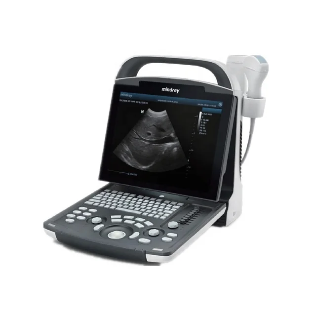 Mindray DP-20 Ultrasound Scanner B/W Portable Ultrasound Machine Ultrasonic Diagnostic Imaging System