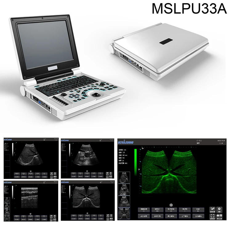 Máquina de ultrasonido portátil médico Laptop Ultrasonido Fisioterapia B/W Escáner de ultrasonido digital portátil