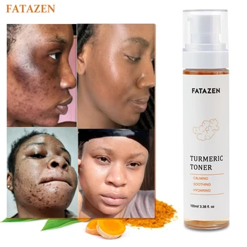 Private Label Skin Care Moisturizing Turmeric Facial Mist Repair Toner Spray Natural Organic Deep Hydrating Turmeric Face Toner