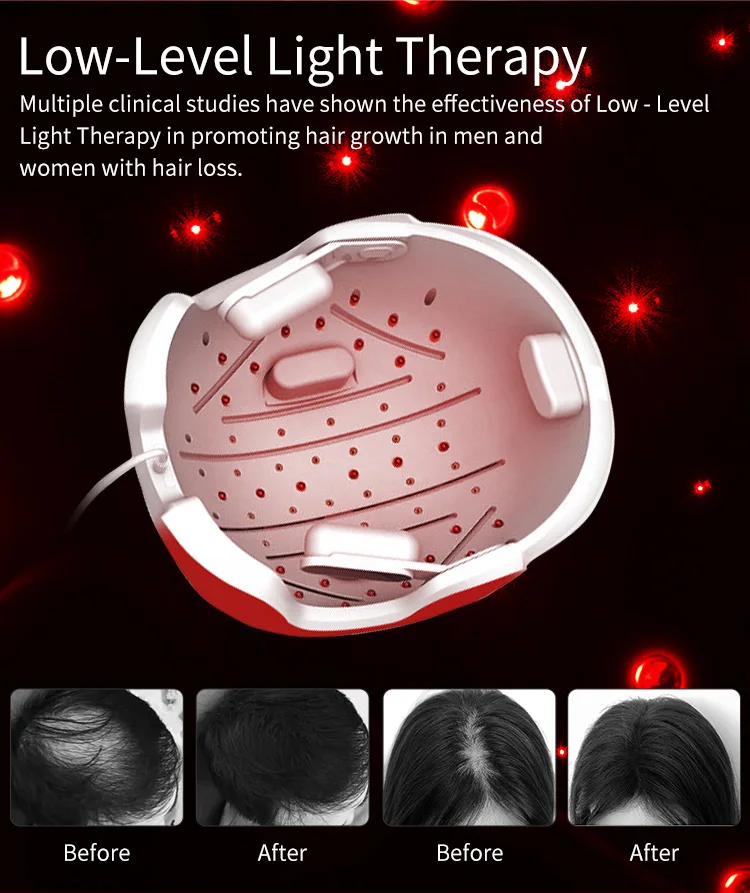 Redyut New Arrival Led Red Light With Time Control Hair Growth Helmet