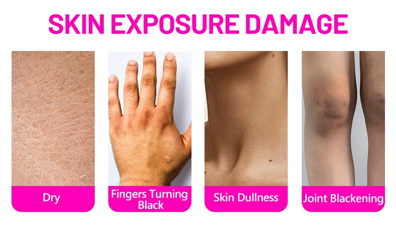 Aichun Beauty 30ml Organic Natural Joint Supe Whitening Serum With Vitamin E Strong Whitening Serum Body for Black Skin